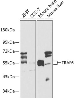 Anti-TRAF6 Antibody (CAB0973)