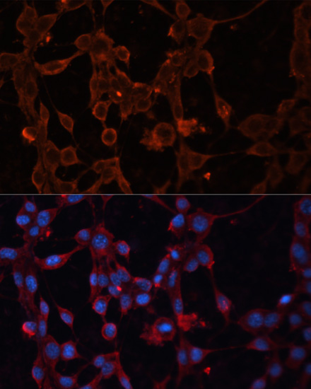 Anti-SLC25A27 Antibody (CAB13834)