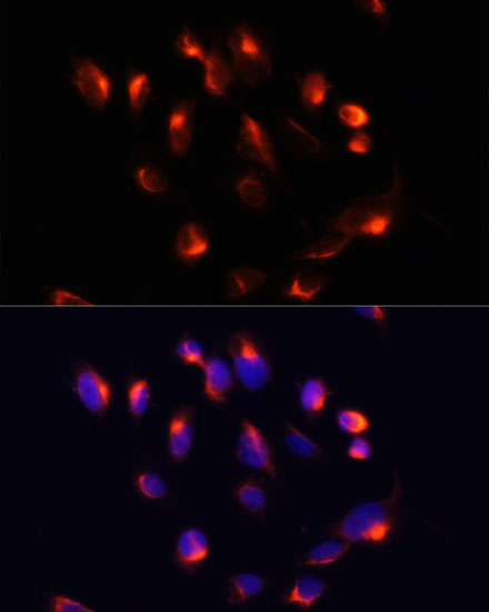 Anti-CYP3A4 Antibody (CAB2544)