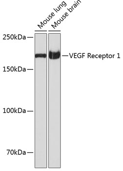 Anti-VEGF Receptor 1 Antibody (CAB19132)