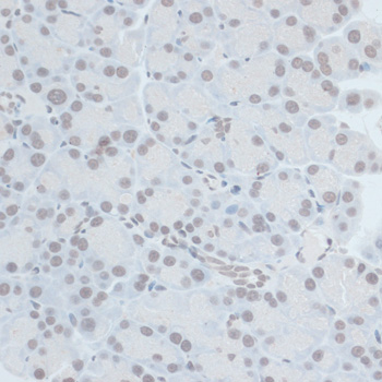 Anti-ZNF703 Antibody (CAB14325)