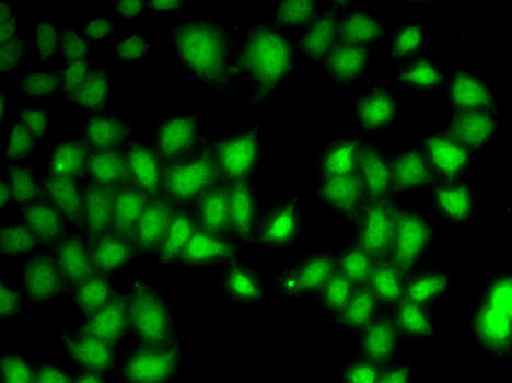 Anti-WNT7A Antibody (CAB5425)