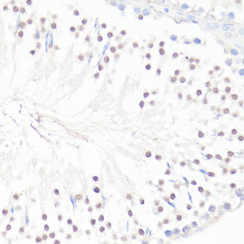 Anti-GLI1 Antibody (CAB14675)