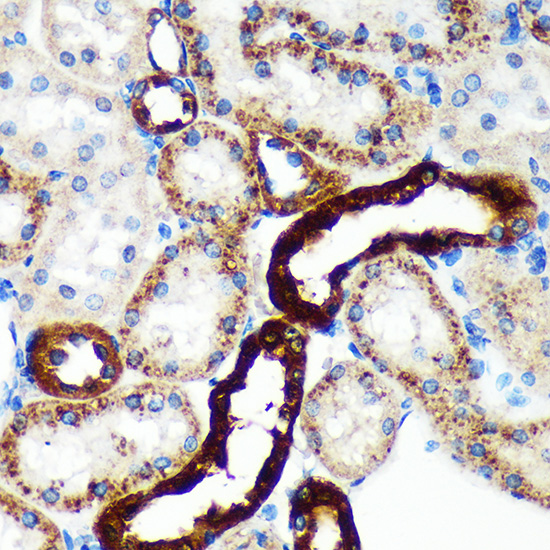 Anti-EML4 Antibody (CAB16117)