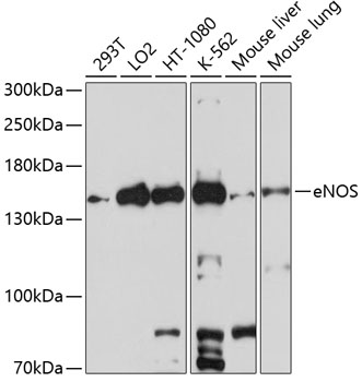 Anti-eNOS Antibody (CAB1548)