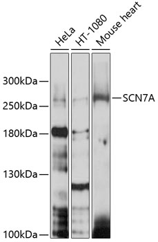 Anti-SCN7A Antibody (CAB10088)