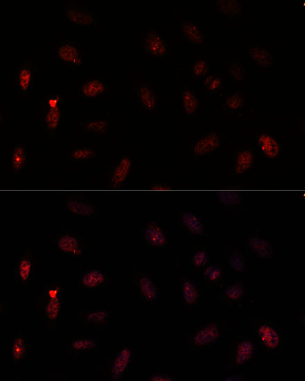 Anti-PAX6 Antibody (CAB7334)