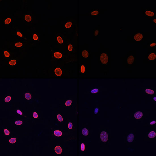 Anti-Acetyl-Histone H4-K91 Antibody (CAB7409)