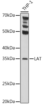 Anti-LAT Antibody (CAB5650)