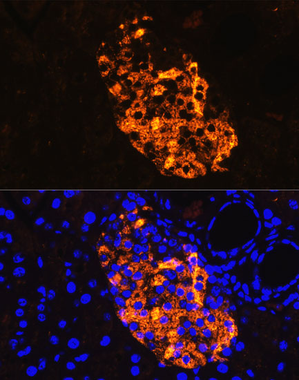 Anti-IAPP Antibody (CAB2816)