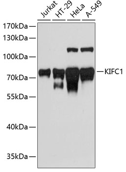 Anti-KIFC1 Antibody (CAB3304)