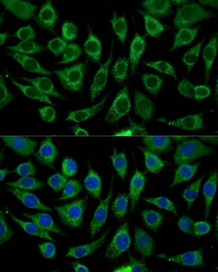 Anti-ABCD2 Antibody (CAB16033)