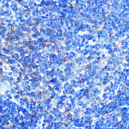 Anti-PKM Antibody (CAB16700)