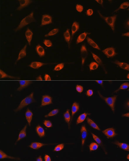 Anti-TP53I13 Antibody (CAB15924)