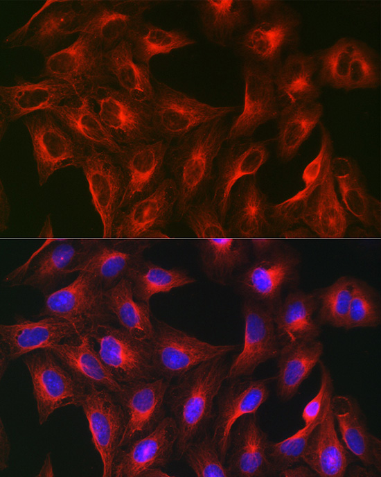 Anti-Alpha-Tubulin Mouse Monoclonal Antibody (CABC012)