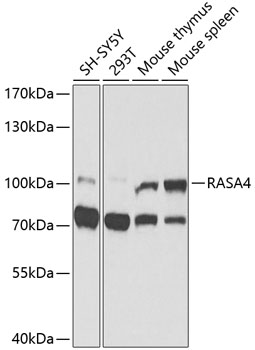 Anti-RASA4 Polyclonal Antibody (CAB9860)