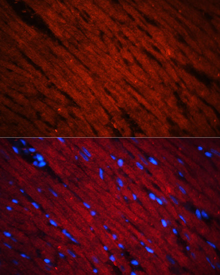 Anti-SOS1 Antibody (CAB3272)