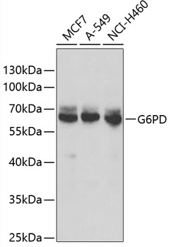 Anti-G6PD Antibody (CAB13983)