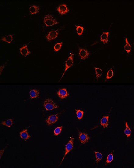 Anti-PSEN1 Antibody (CAB2187)