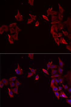 Anti-RAMP3 Antibody (CAB6715)