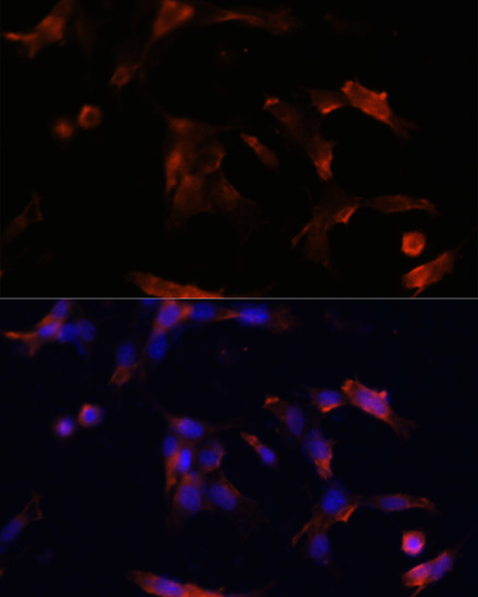 Anti-Aquaporin-5 Polyclonal Antibody (CAB9927)