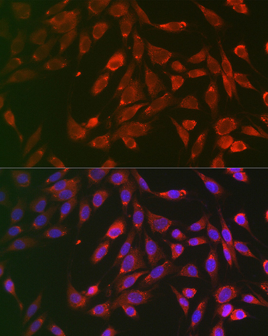 Anti-TNFR1 Antibody (CAB1540)