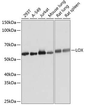 Anti-LOX Antibody