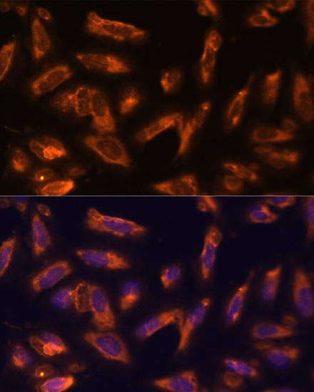 Anti-CSF2 Antibody (CAB6127)