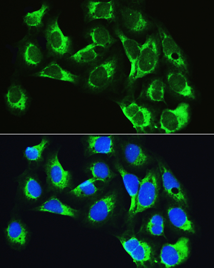 Anti-LARS Antibody (CAB14890)