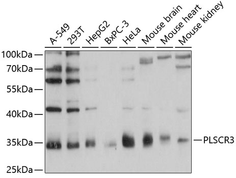 Anti-PLSCR3 Antibody (CAB12371)