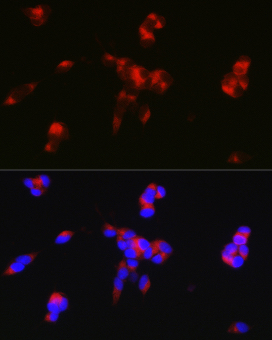 Anti-PPP1R1B Antibody (CAB2580)