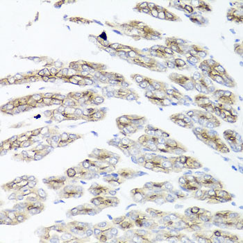 Anti-IER3 Polyclonal Antibody (CAB8566)