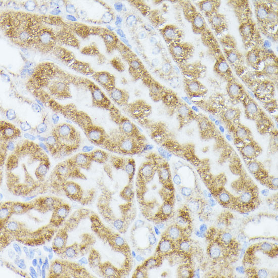 Anti-ACAT2 Antibody (CAB7866)