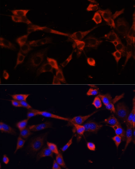 Anti-DNASE1L1 Antibody (CAB13150)