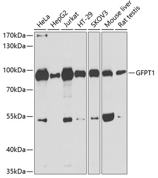 Anti-GFPT1 Antibody (CAB3882)