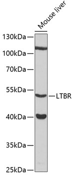 Anti-LTBR Antibody (CAB12006)