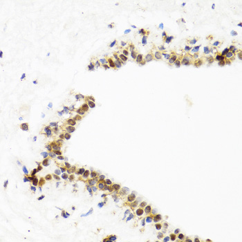 Anti-TOP1 Antibody (CAB7741)