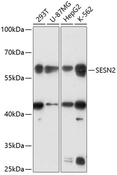 Anti-SESN2 Antibody (CAB14220)