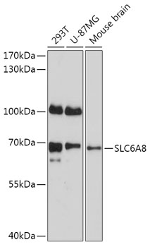 Anti-SLC6A8 Antibody (CAB17531)