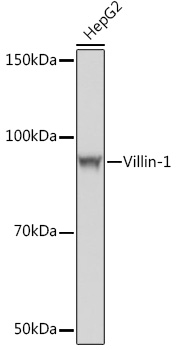 Anti-Villin-1 Antibody (CAB4691)