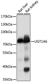 Anti-UGT1A6 Antibody (CAB10033)