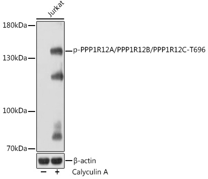 Anti-Phospho-PPP1R12A/PPP1R12B/PPP1R12C-T696 Antibody (CABP1164)