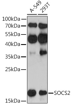 Anti-SOCS2 Antibody (CAB17035)