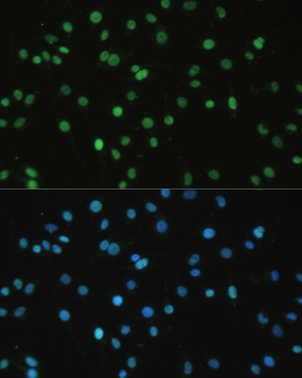 Anti-SET Antibody (CAB6212)