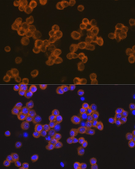 Anti-NLRP3 Antibody (CAB14223)