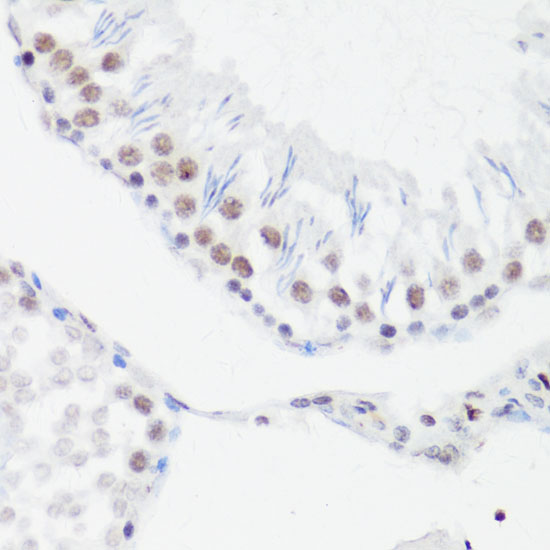 Anti-MonoMethyl-Histone H4-R3 Antibody (CAB3158)