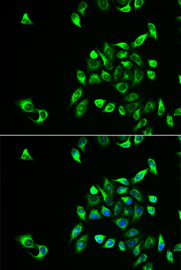 Anti-CSNK1A1L Antibody (CAB6490)