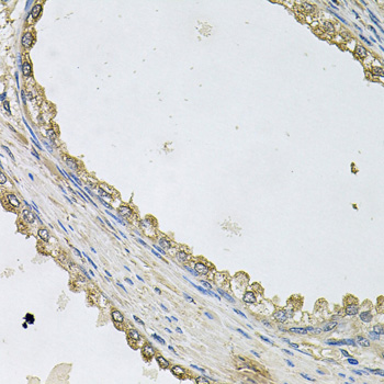 Anti-MTERFD1 Polyclonal Antibody (CAB9804)