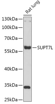 Anti-SUPT7L Antibody (CAB17601)