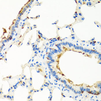 Anti-RGS5 Antibody (CAB7015)